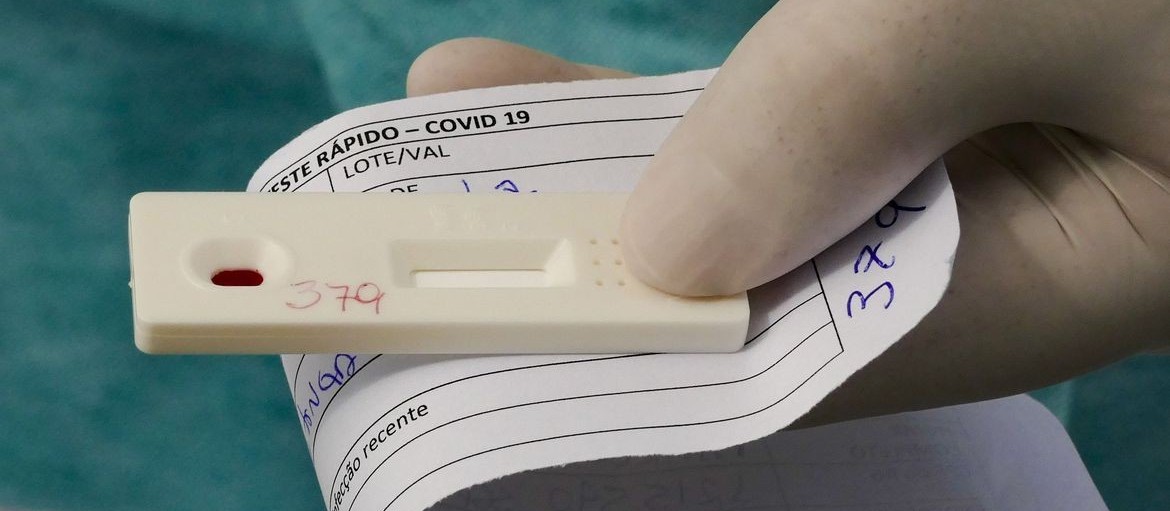 Taxa de positividade em exames realizados por laboratório particular dispara