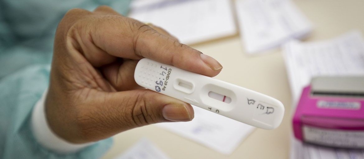 Anvisa autoriza autoteste para detectar Covid-19