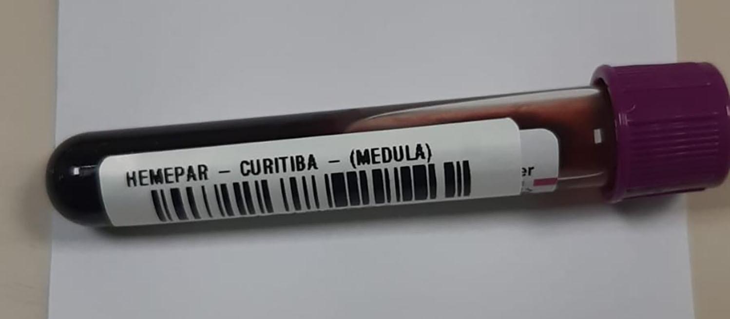 Campanha alerta para diagnóstico precoce da leucemia