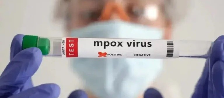 Maringá investiga dez casos suspeitos de mpox