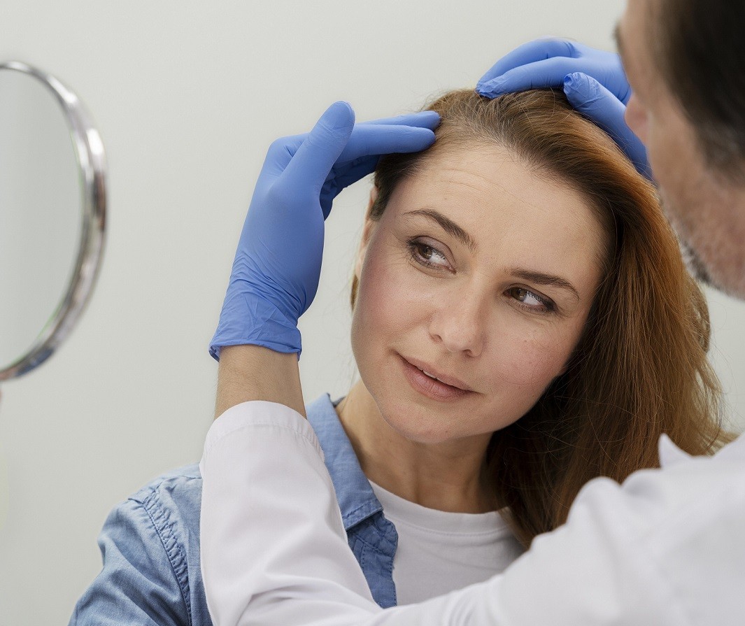 Entenda o que é alopecia areata, doença que atinge 1% da população