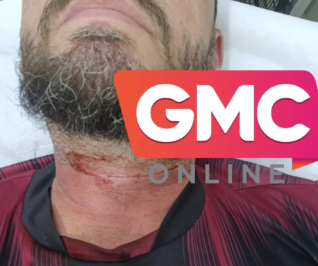 Motociclista sofre corte no pescoço provocado por linha chilena